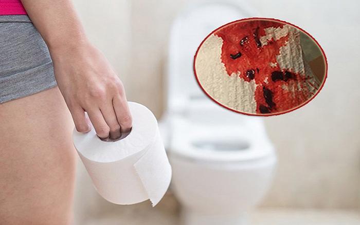 Blood In Stool After Drinking-4