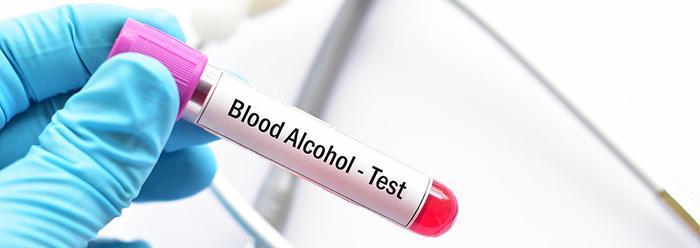 Can You Drink Alcohol Before A Blood Test-4