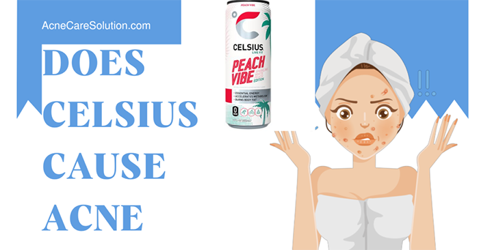 Does Celsius Give You Acne (1)