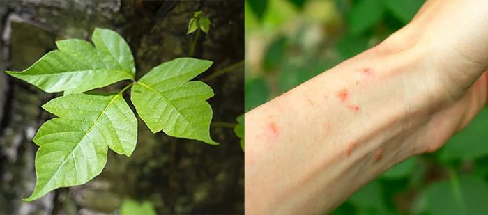 Does Alcohol Kill Poison Ivy (1)