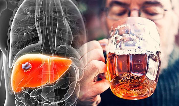 Does Non Alcoholic Beer Affect Liver Enzymes (1)