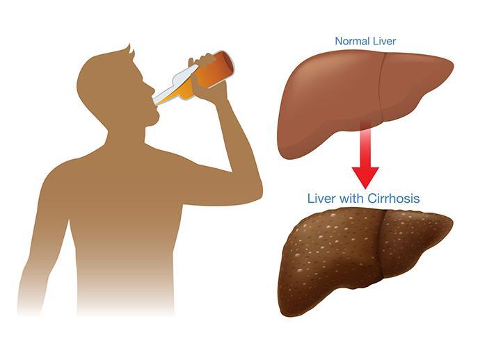 What Alcohol Is Easiest On Your Liver 